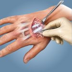 OrthoWrap®01.jpg