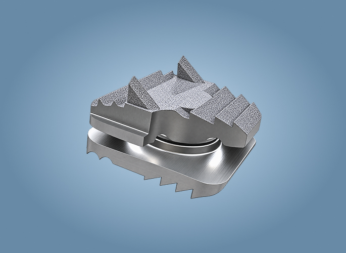 MONOBLOCK01